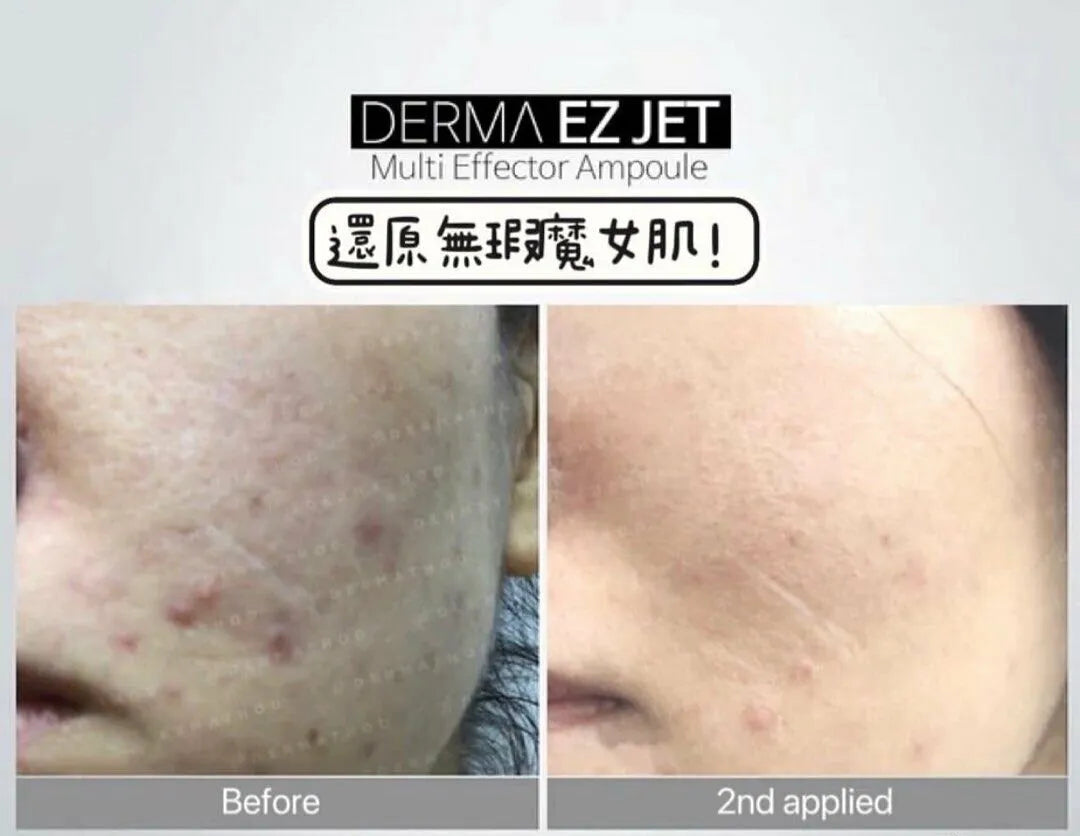 Derma Ez Jet魔女印