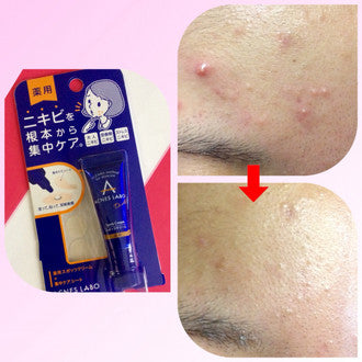 Acnes Labo 藥用集中護理抗痘暗瘡膏 7g 附帶抗痘修護貼