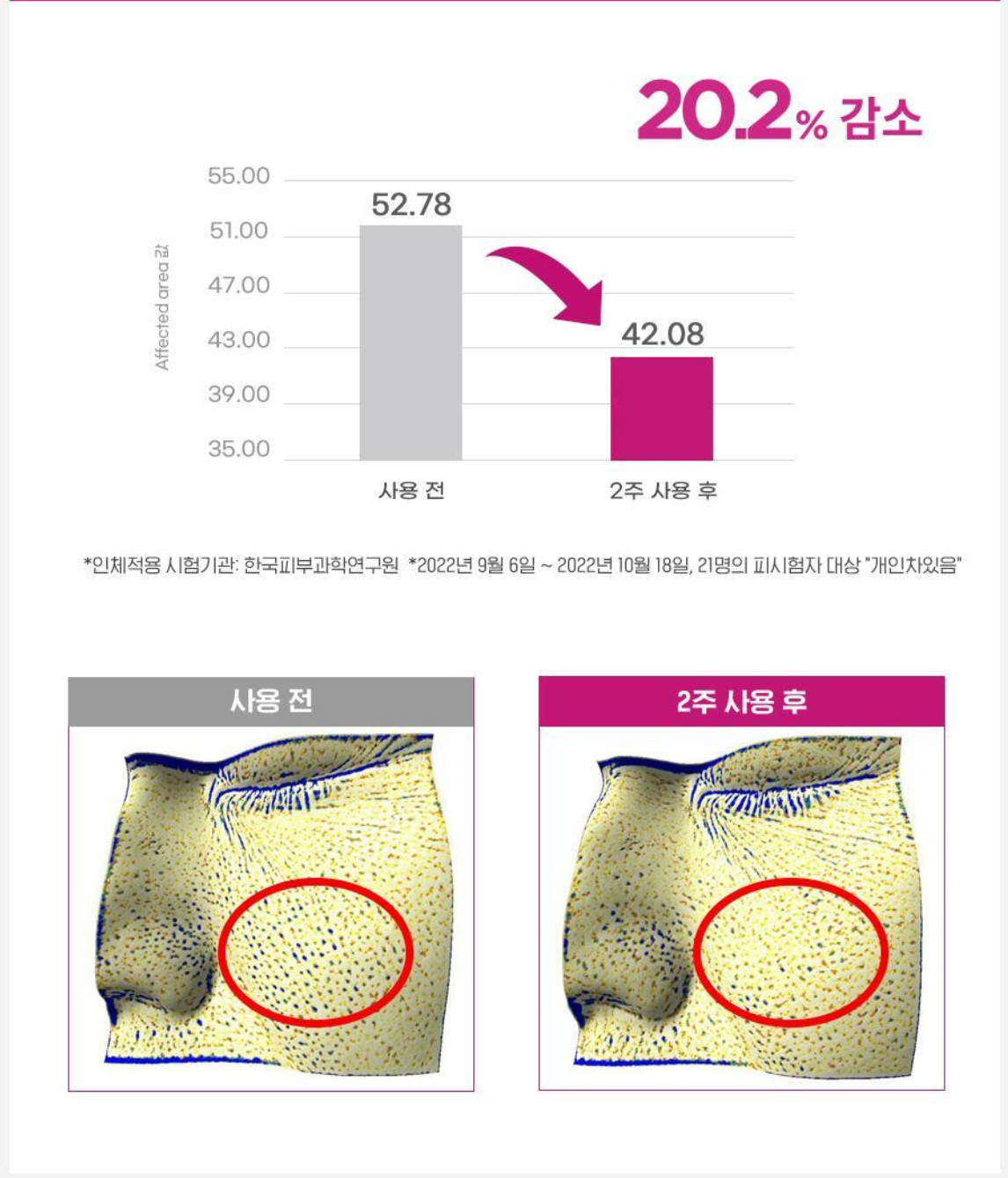 CKD Retino Collagen Small Molecule 300 Pore & Easticity Mask 維A視黃醇低分子膠原蛋白毛孔彈力緊緻果凍面膜